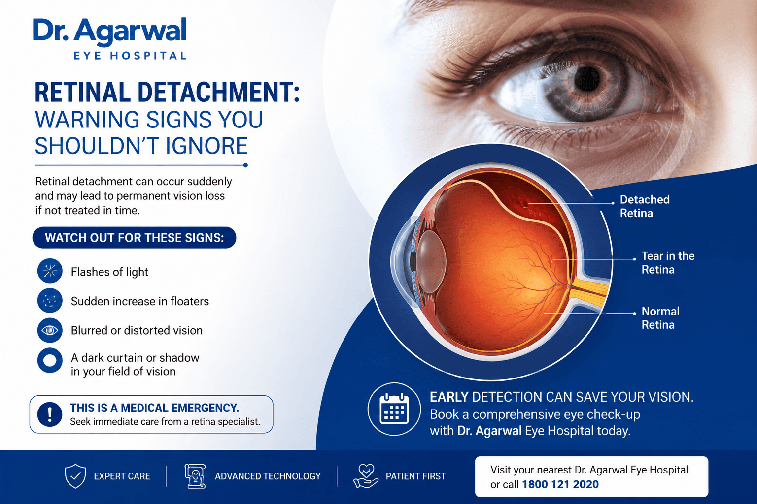 Retinal Detachment: Warning Signs You Shouldn’t Ignore featured image